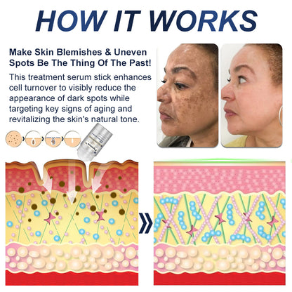 🏆Official Store: flysmus™ Collagen Peptides Skin Treatment Serum Stick👨‍⚕️ TGA Registered (💝 4-in-1 Anti-Wrinkle, Smooth Treatment, Dark Spot Remover, Anti-Inflammatory🔥