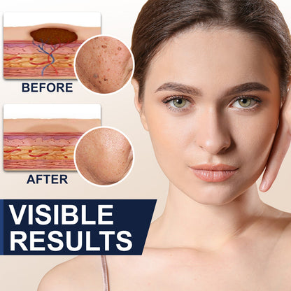 🏆Official Store: flysmus™ Collagen Peptides Skin Treatment Serum Stick👨‍⚕️ TGA Registered (💝 4-in-1 Anti-Wrinkle, Smooth Treatment, Dark Spot Remover, Anti-Inflammatory🔥