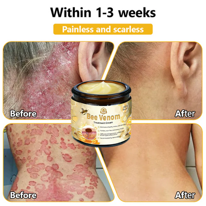 Turonu™ Bee Venom Skin Treatment Cream (AAD Recommended)