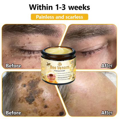 Turonu™ Bee Venom Skin Treatment Cream (AAD Recommended)