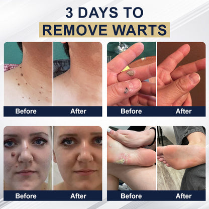 🏆Official Store: flysmus™ Collagen Peptides Skin Treatment Serum Stick👨‍⚕️ TGA Registered (💝 4-in-1 Anti-Wrinkle, Smooth Treatment, Dark Spot Remover, Anti-Inflammatory🔥
