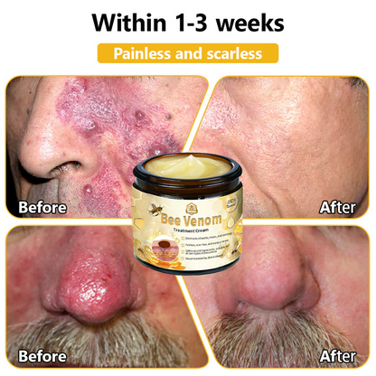 Turonu™ Bee Venom Skin Treatment Cream (AAD Recommended)
