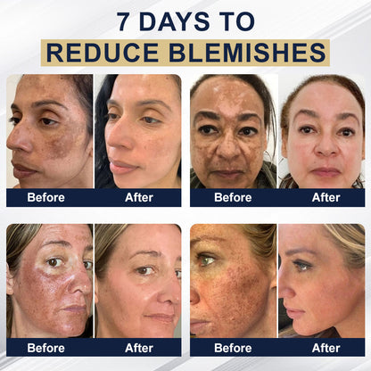 🏆Official Store: flysmus™ Collagen Peptides Skin Treatment Serum Stick👨‍⚕️ TGA Registered (💝 4-in-1 Anti-Wrinkle, Smooth Treatment, Dark Spot Remover, Anti-Inflammatory🔥