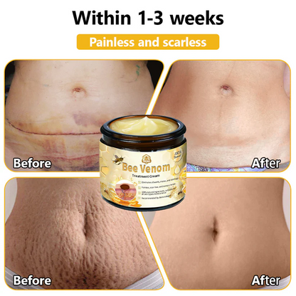Turonu™ Bee Venom Skin Treatment Cream (AAD Recommended)