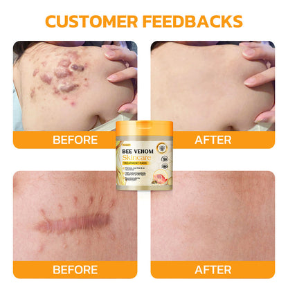 🏆✅TGA Endorsed | Furzero™ Bee Venom Skincare Treatment Pads